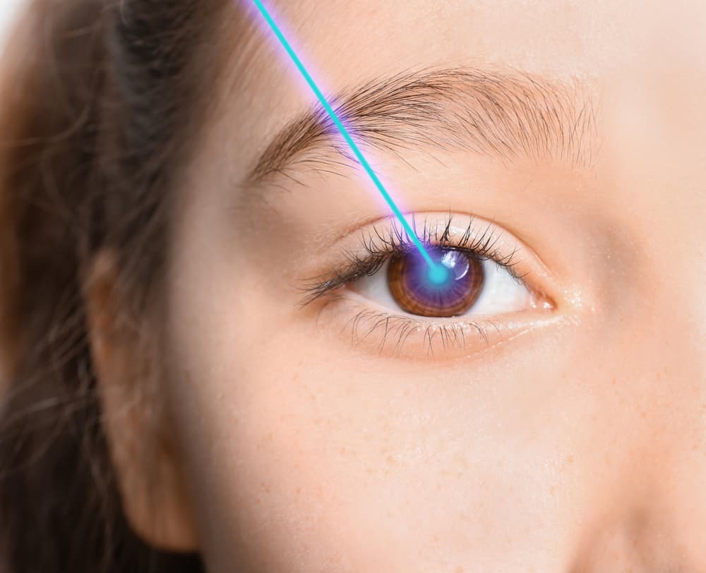 Amankah Operasi Lasik Mata untuk Anak-Anak?